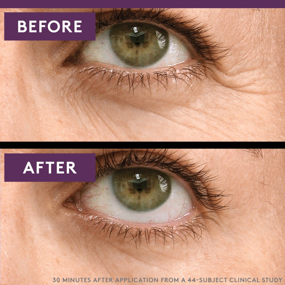 Simply Ageless Eye Lift Serum - US 1451